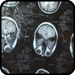 Brain Scan